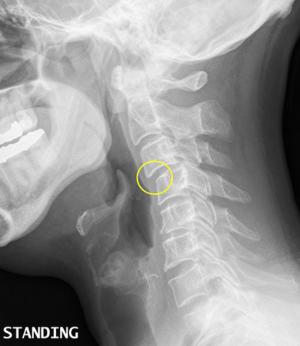 mri.jpg