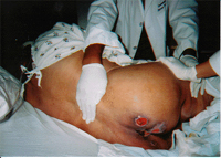 nursing home abuse.jpg